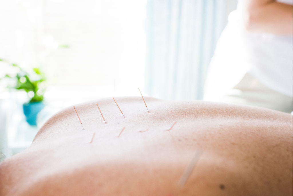 Relaxing acupuncture treatment environment at Hong Tao Clinic