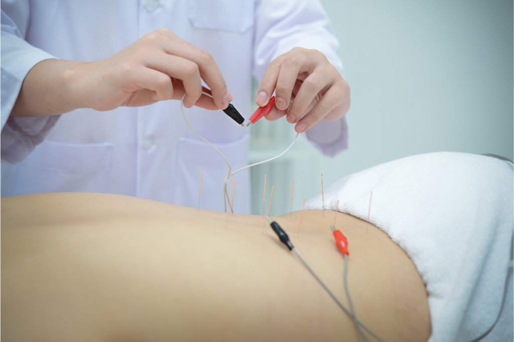 Electroacupuncture providing gentle electrical stimulation to acupuncture needles